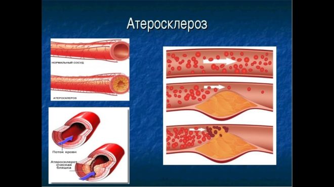 ajánlások a cardiomagnyl alkalmazására