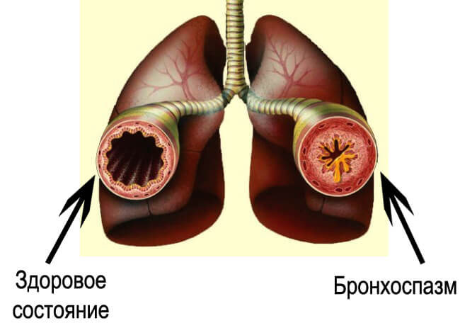 cardiomagnet - blakusparādības un kontrindikācijas